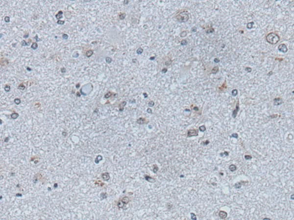 Immunohistochemistry of paraffin-embedded Human brain tissue using EFNB1 Polyclonal Antibody at dilution of 1:50(×200)
