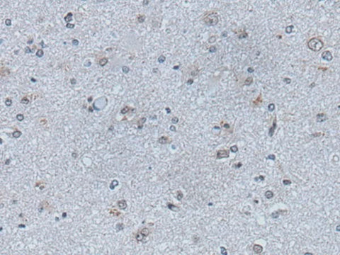Immunohistochemistry of paraffin-embedded Human brain tissue using EFNB1 Polyclonal Antibody at dilution of 1:50(×200)