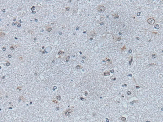 Immunohistochemistry of paraffin-embedded Human brain tissue using EFNB1 Polyclonal Antibody at dilution of 1:50(×200)