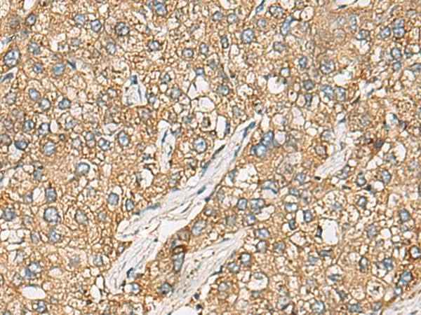 Anti-Human CHKA Antibody