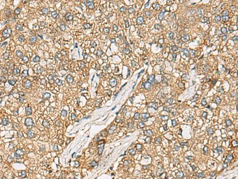 Anti-Human CHKA Antibody - ABMIUM