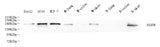 Western Blot analysis of various samples using EGFR Polyclonal Antibody at dilution of 1:1000.