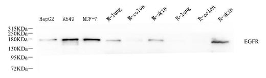 Western Blot analysis of various samples using EGFR Polyclonal Antibody at dilution of 1:1000.