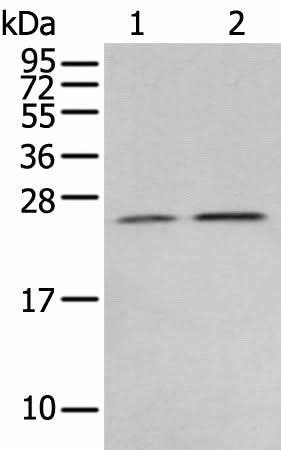 Western blot analysis of Human fetal brain tissue 231 cell using RAB11A Polyclonal Antibody at dilution of 1:400