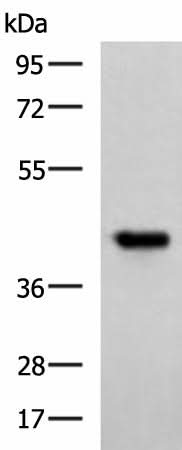 Western blot analysis of Ramos cell lysate using FCRLA Polyclonal Antibody at dilution of 1:750