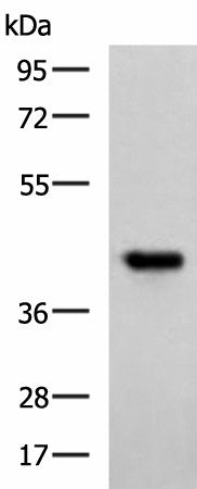 Western blot analysis of Ramos cell lysate using FCRLA Polyclonal Antibody at dilution of 1:750