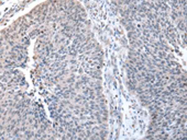 Anti-Human ZNF23 Antibody