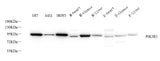 Western Blot analysis of various samples using PI 3 kinase p85 alpha Polyclonal Antibody at dilution of 1:1000.