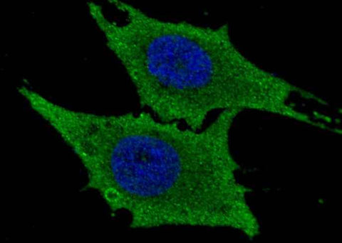 Anti-Human LTA4H Antibody [A1225] - ABMIUM