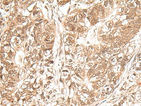 Anti-Human USP16 Antibody - ABMIUM