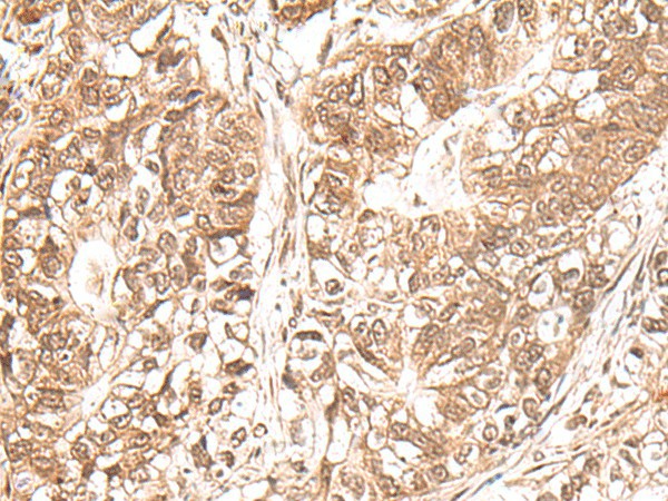 Anti-Human USP16 Antibody - ABMIUM