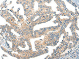 Anti-Human GPR55 Antibody - ABMIUM
