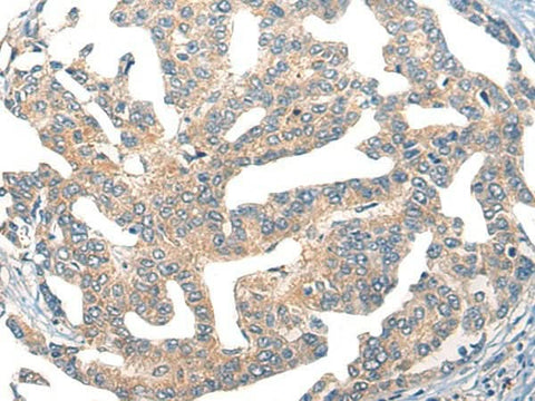Anti-Human GPR55 Antibody - ABMIUM