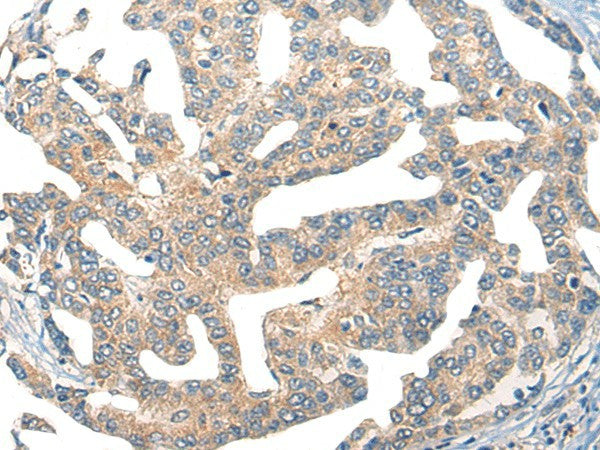Anti-Human GPR55 Antibody - ABMIUM