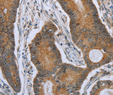 Anti-Human/Mouse TNFRSF13C Antibody - ABMIUM