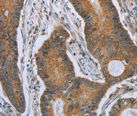 Anti-Human/Mouse TNFRSF13C Antibody