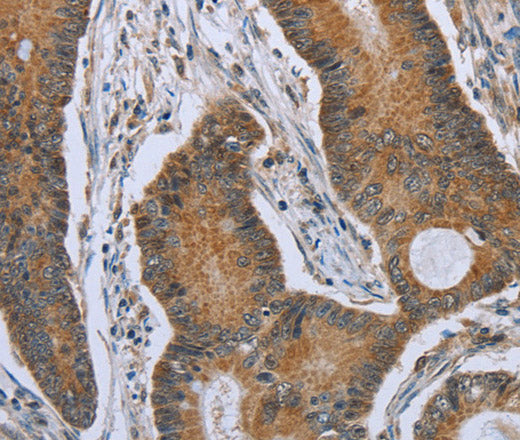 Anti-Human/Mouse TNFRSF13C Antibody - ABMIUM
