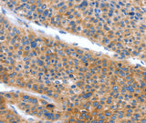 Anti-Human ARL11 Antibody - ABMIUM