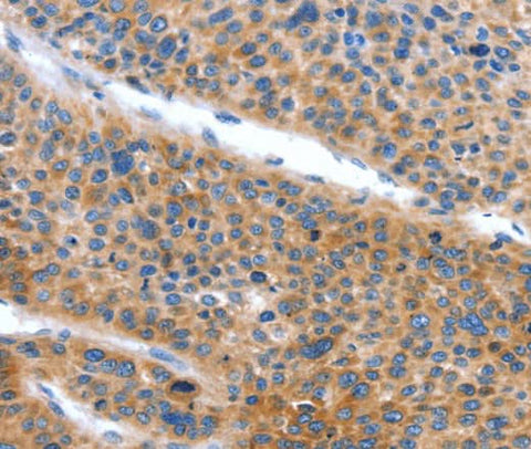 Anti-Human ARL11 Antibody - ABMIUM