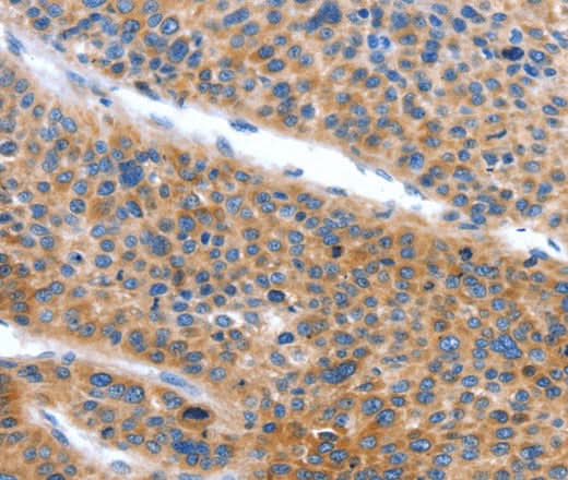 Anti-Human ARL11 Antibody - ABMIUM