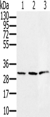 Anti-Human/Mouse/Rat HSD17B8 Antibody - ABMIUM