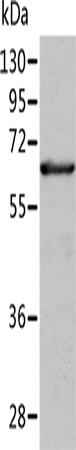 Anti-Human/Mouse/Rat ALDH4A1 Antibody - ABMIUM