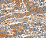 Anti-Human/Mouse CUEDC2 Antibody - ABMIUM