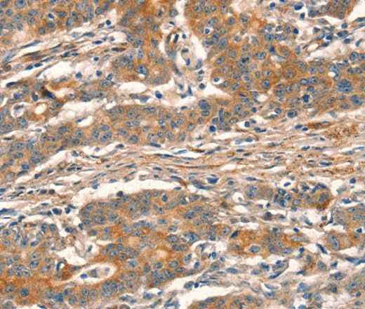 Anti-Human/Mouse CUEDC2 Antibody