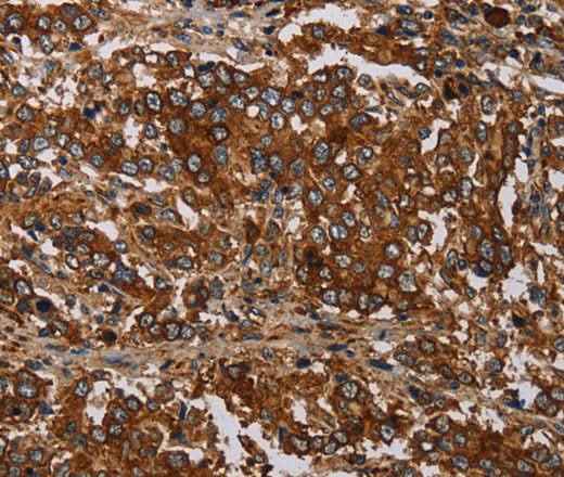 Anti-Human MAGEC2 Antibody