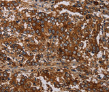 Anti-Human MAGEC2 Antibody - ABMIUM