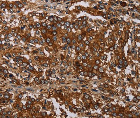 Anti-Human MAGEC2 Antibody - ABMIUM
