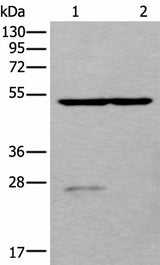 Western blot analysis of Human left kidney tissue and Human fetal liver tissue lysates using DDC Polyclonal Antibody at dilution of 1:800