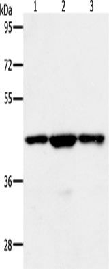 Anti-Human/Mouse/Rat MAP2K1 Antibody - ABMIUM