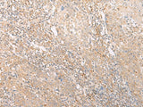 Anti-Human/Mouse EPS15 Antibody - ABMIUM