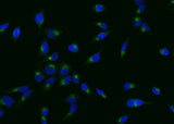 Anti-Human SELPLG Antibody [A1085] - ABMIUM