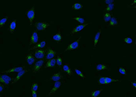 Anti-Human SELPLG Antibody [A1085] - ABMIUM