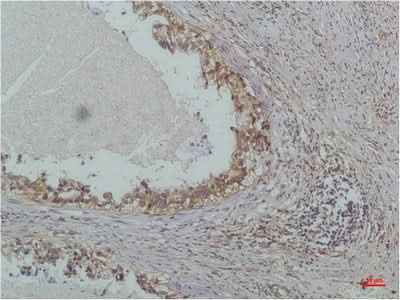 Anti-Human/Mouse/Rat IκB β Antibody [3E4]