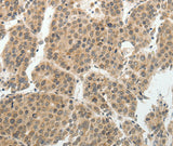 Anti-Human/Mouse SOCS7 Antibody - ABMIUM