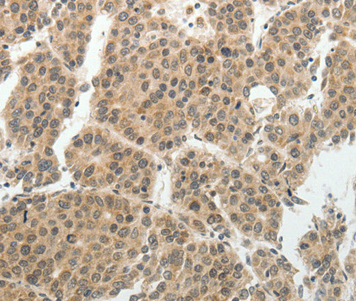 Anti-Human/Mouse SOCS7 Antibody - ABMIUM