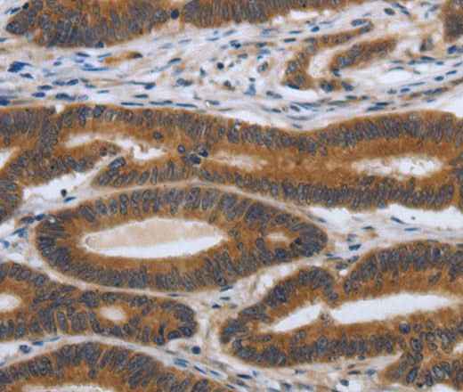 Anti-Human/Mouse/Rat PDGFA Antibody