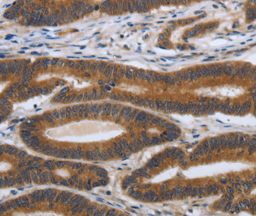Anti-Human/Mouse/Rat PDGFA Antibody - ABMIUM