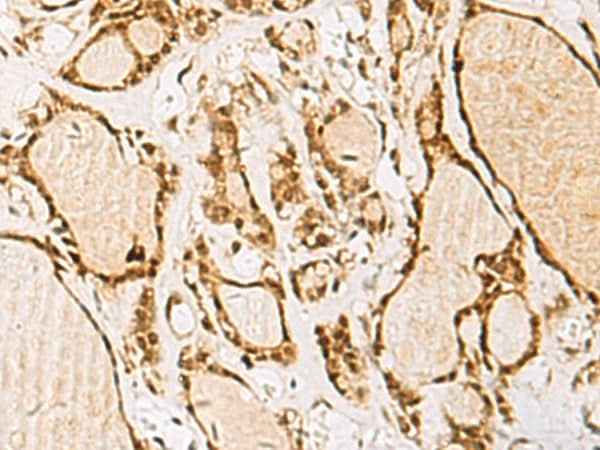 Anti-Human/Mouse NIPBL Antibody