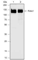Anti-Human Robo1 Antibody [A647]