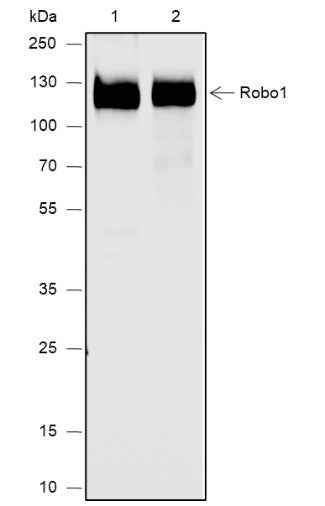 Anti-Human Robo1 Antibody [A647] - ABMIUM