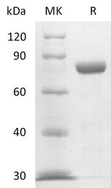 Recombinant Mouse Nectin-4 (C-Fc) - ABMIUM