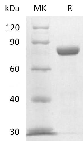 Recombinant Mouse Nectin-4 (C-Fc) - ABMIUM