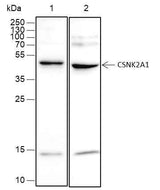 Anti-Human/Rat CSNK2A1 Antibody [A462]