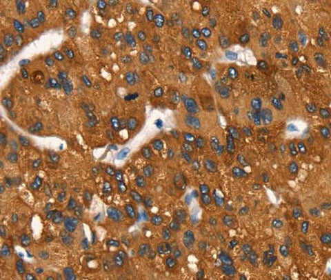 Anti-Human MT-CYB Antibody - ABMIUM