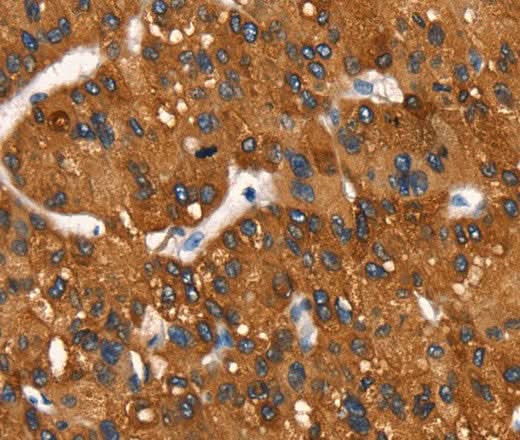 Anti-Human MT-CYB Antibody - ABMIUM