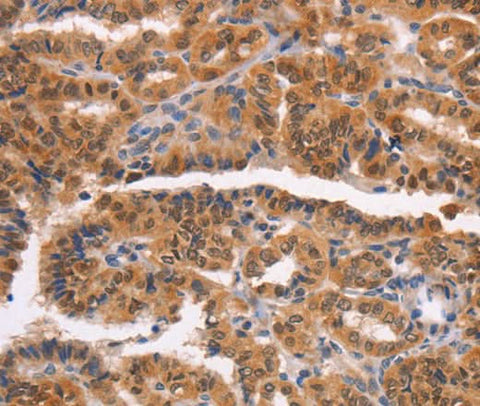 Anti-Human NCAPG2 Antibody - ABMIUM